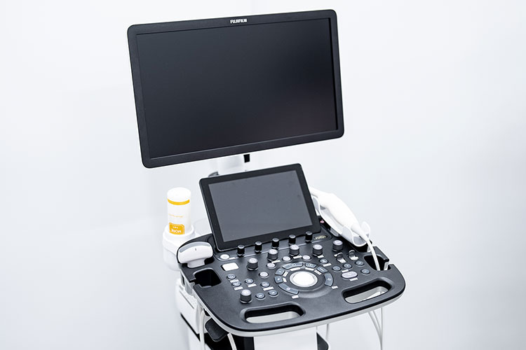 超音波検査装置