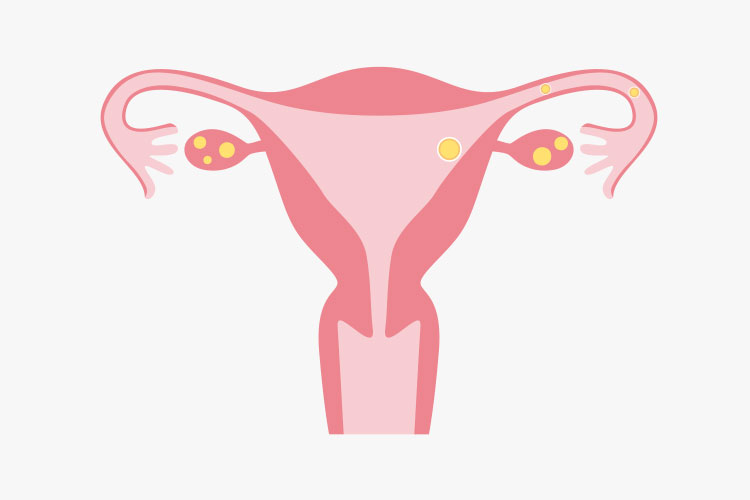 不育症・着床障害イメージ